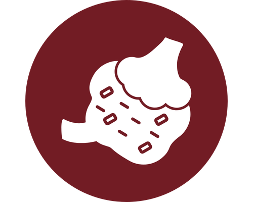 Adana Polikistik Over (PKOS) Kısırlık Tedavisi