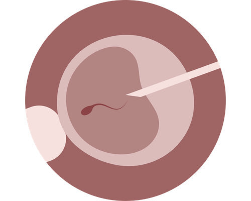 Adana Tüp Bebek Öncesi Hazırlık ve Destekleyici Tedaviler