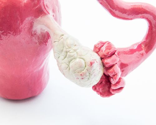 Adana Polikistik Over (PKOS) Kısırlık Tedavisi