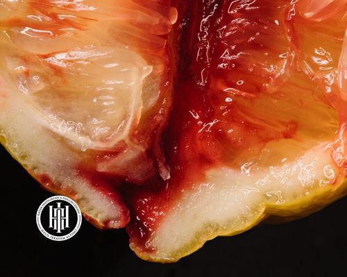 Bartholin Kisti Nedir?