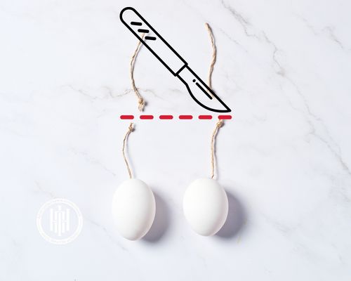 Tüp Ligasyonu (Tüplerin Bağlanması) Nedir?