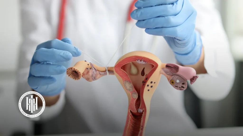 Tüplerin Açılması Tuboplasti İşlemi Nedir?